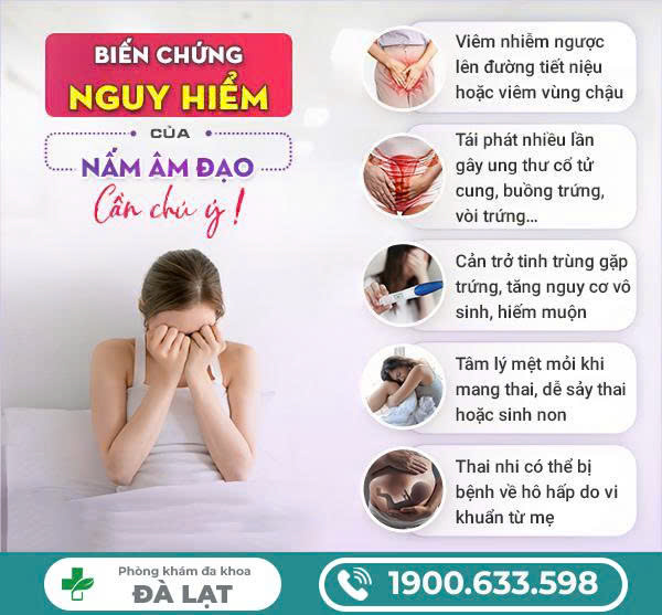 Hình ảnh minh họa
